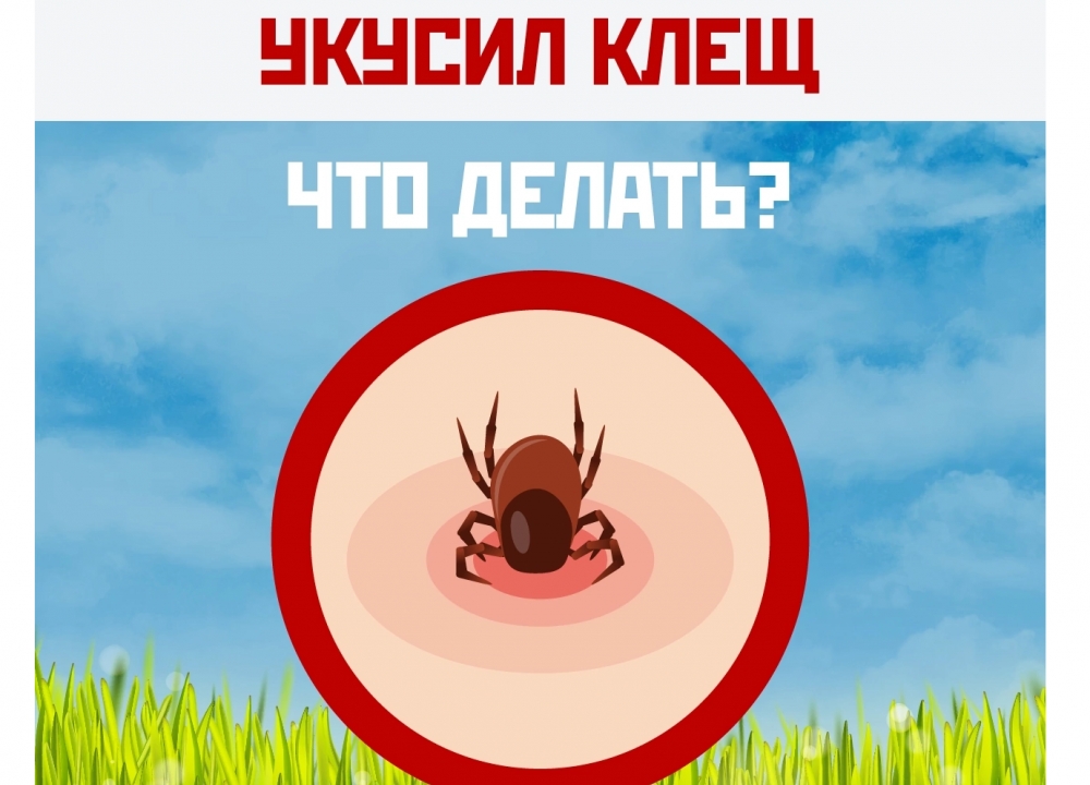 Клещи